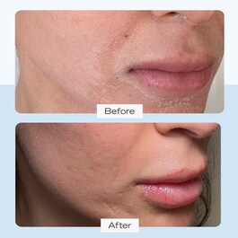 Ultra Repair Cream Intense Hydration - Crema ultra reparación