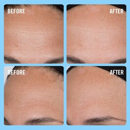 Ultra Repair Firming Collagen - Hidratante Reafirmante de Colágeno