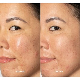 Glow 2OH Dark Spot Toner - Tónico Facial Anti-manchas con AHA
