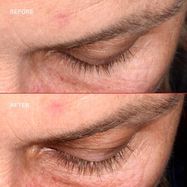 Lashbond™ - Sérum De Pestañas