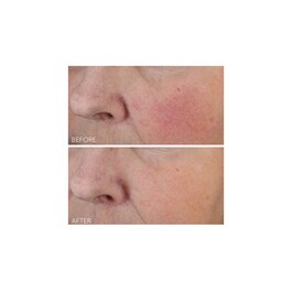 Vitamin C + Lactic - Tratamiento Hidratante Intenso Firmeza Lift