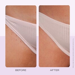 Ingrown Hair Pads - Discos compostables para vello encarnado x60