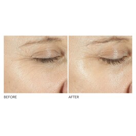 Advanced Retinol + Ferulic - Sérum Contorno de Ojos Triple Corrección