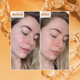 Radiance ready steady glow-Tónico diario