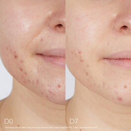 Vinopure Sérum Salicílico Anti-imperfecciones -Sérum