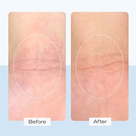 Ultra Repair Cream Intense Hydration - Crema ultra reparación
