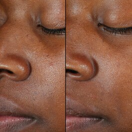 Kombucha - Tónico Exfoliante Rostro