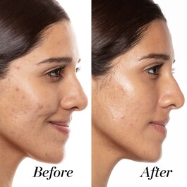 A+ - Sérum ultraconcentrado con retinoides
