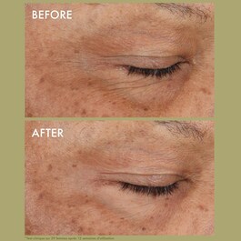 Plantscription™ - Crema de ojos correctora de arrugas con retinol encapsulado