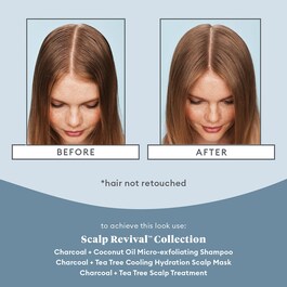 Scalp Revival Charcoal - Tratamiento para el cuero cabelludo 