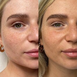 THE FACE - Gotas autobronceadoras