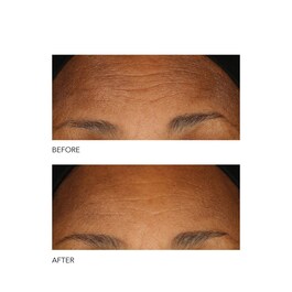 Alpha Beta® - Peeling Diario Fórmula Intensa