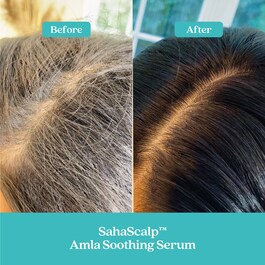 SahaScalp™ - Sérum hidratante 