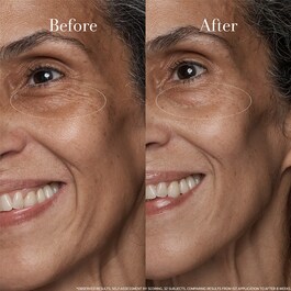 Black Tea Age Renewal Eye Concentrate – Crema de ojos antiedad de té negro