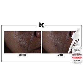 Sérum Ultra Pure - Suero facial con ácido glicólico