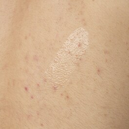 Sérum Corporal con Ácido Salicílico 0,5 %  - Sérum Corporal Antiimperfecciones