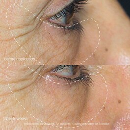Awaken Peptide Eye Gel - Gel contorno de ojos