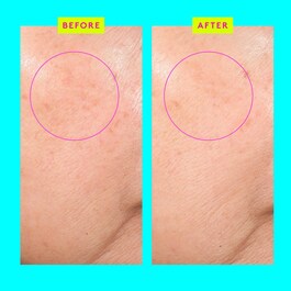 Bouncy Brightfacial™ - Mascarilla Facial Sin Aclarado