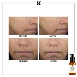 Kiehl's Powerful Strength Line - Serum Anti-Edad