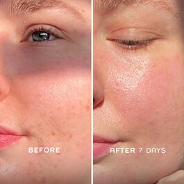 Evercalm™ - Elixir fortificante de barrera cutánea