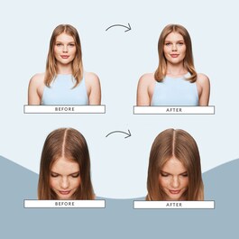 Soluciones para el cuero cabelludo graso - Set para el cabello