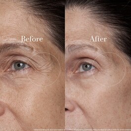 Black Tea Age Renewal Eye Concentrate – Crema de ojos antiedad de té negro