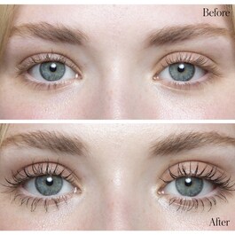 Duo Lift + Light Eyes - Dúo para los ojos
