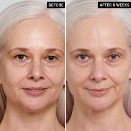 Sérum antiedad con retinol