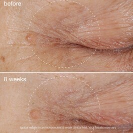 Biolumin-C Eye Serum - Contorno de ojos aclarador con vitamina C