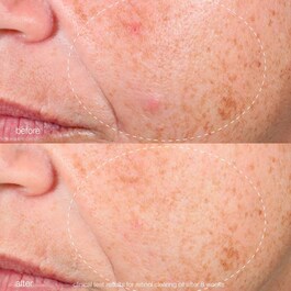 Retinol Clearing Oil - Aceite Purificante con Retinol