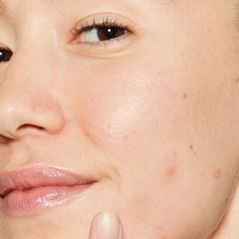 Deep Breakout Liquid Patch - Tratamiento anti-imperfecciones