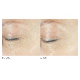 Advanced Retinol + Ferulic - Sérum Contorno de Ojos Triple Corrección