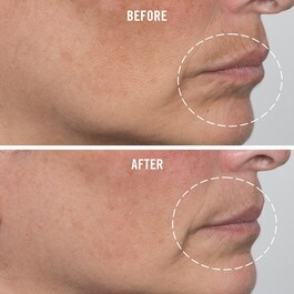 Ultra Repair Firming Collagen - Hidratante Reafirmante de Colágeno