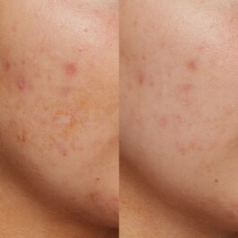B3 Nice 10% Niacinamide - Sérum a base de niacinamida y resveratrol