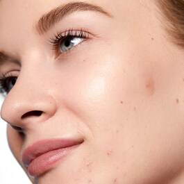 Acne Day Dot - Parches antiimperfecciones