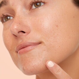 Acne Dots - Parches anti -imperfecciones