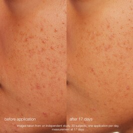Daily Microfoliant - Exfoliante suave enzimático y mecánico
