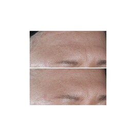 Vitamin C + Lactic - Tratamiento Hidratante Intenso Firmeza Lift