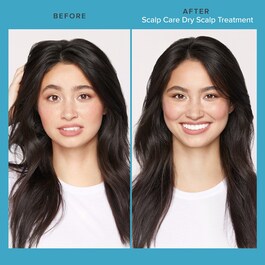 Scalp Care Dry Scalp Treatment - Tratamiento para el cuero cabelludo