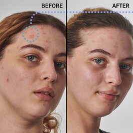 Solución para pieles secas y rugosas con urea al 10% - Suero facial