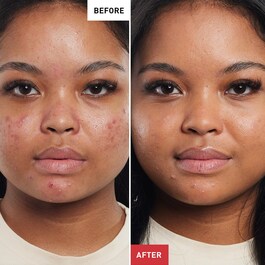 Super BB Au Ginseng - BB Cream  Anti-Imperfecciones