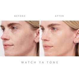 Watch Ya Tone - Sérum anti-manchas con niacinamida y vitamina C