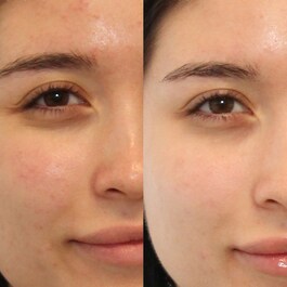 Oil and Pore Control Mattifier Broad Spectrum | SPF 45 - Matificante regulador
