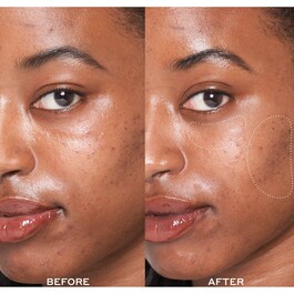Dewtopia 25% Acid Flash Facial - Mascarilla facial exfoliante