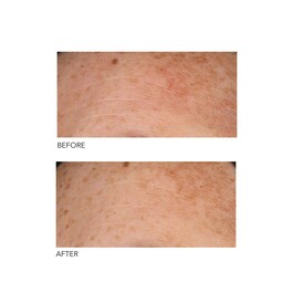 Alpha Beta® - Peeling Diario Fórmula Universal