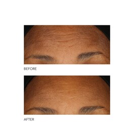 Alpha Beta® - Peeling Diario Fórmula Intensa