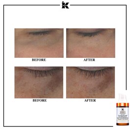  Powerful Strength Line Reducing Concentrate Eye - Contorno de Ojos