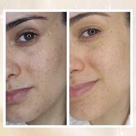 OVERNIGHT DARK SPOT SLEEPING CREAM - Crema de noche