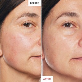 Skin Therapy  - Aceite de Noche Multi-Perfeccionador